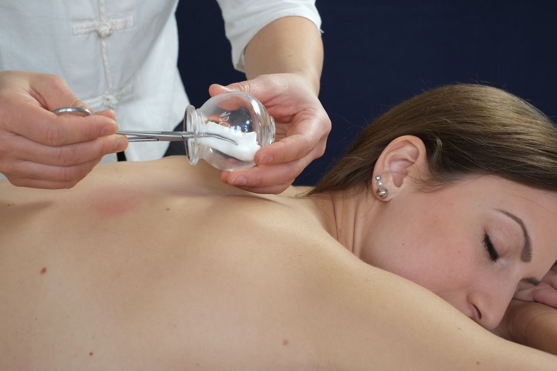 ventouses - Médecine Chinoise HAN Sàrl