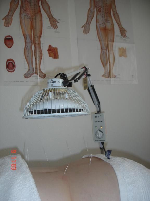 auriculothérapie et acupuncture - Médecine Chinoise HAN Sàrl