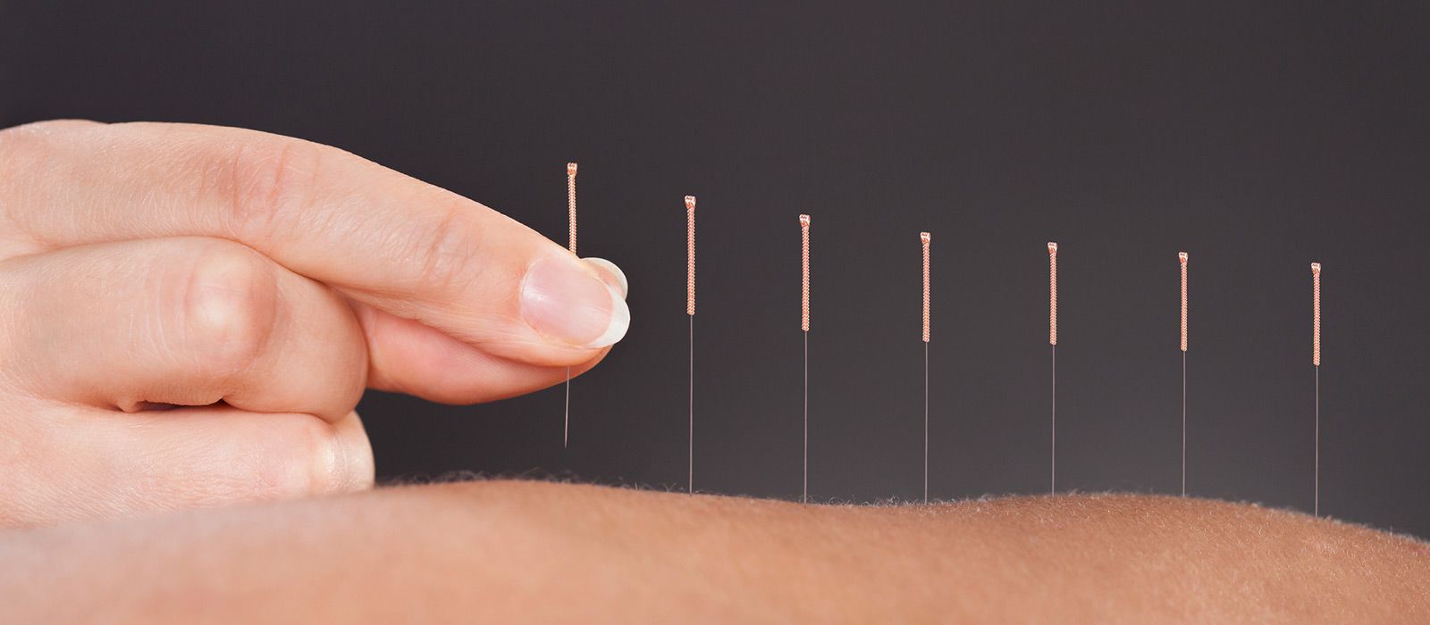 acupuncture - Médecine Chinoise HAN Sàrl