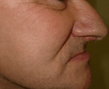 Um close-up de perfil da parte inferior do rosto de uma pessoa, mostrando o nariz, a boca e o queixo.