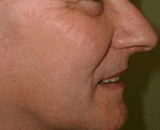 Uma vista de perfil aproximada do rosto de uma pessoa, mostrando o nariz, a boca e o contorno do queixo