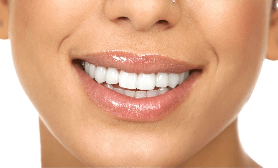 Close-up de uma pessoa com lábios brilhantes sorrindo, exibindo dentes brancos e alinhados.