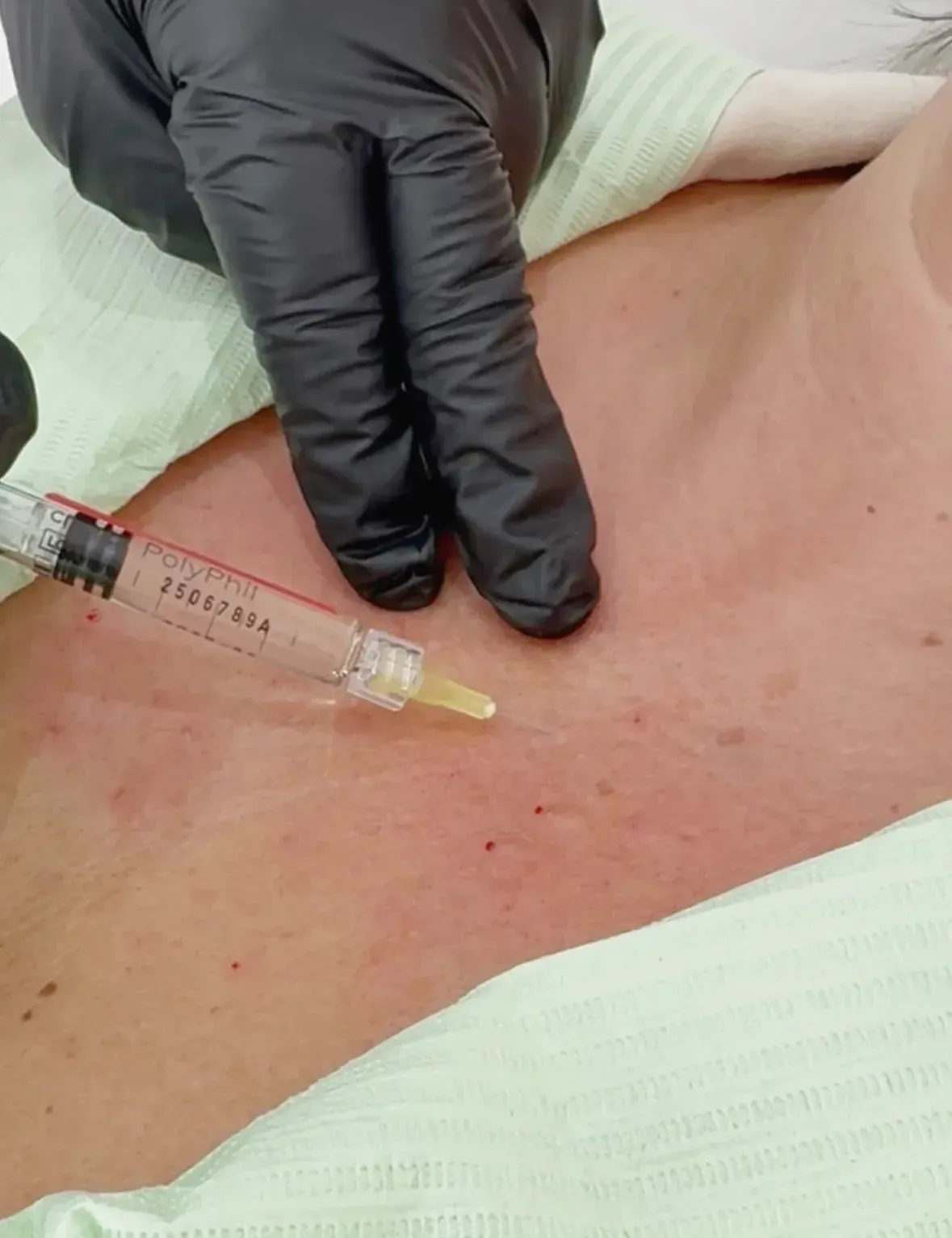 K.Clinic Medicina Estética | Mesoterapia, Inductores y Polinucleótidos