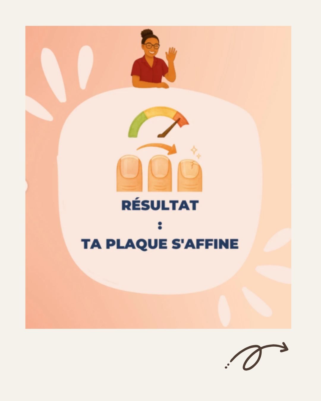 Histoire de l'ongle 5