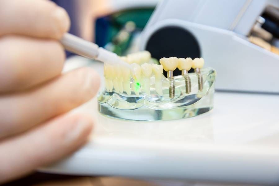 Zahn Laserbehandlung