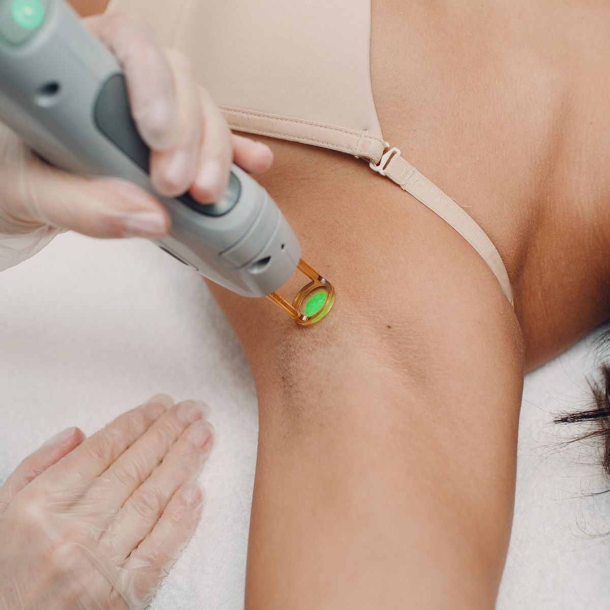Une femme reçoit un traitement au laser sur ses aisselles.
