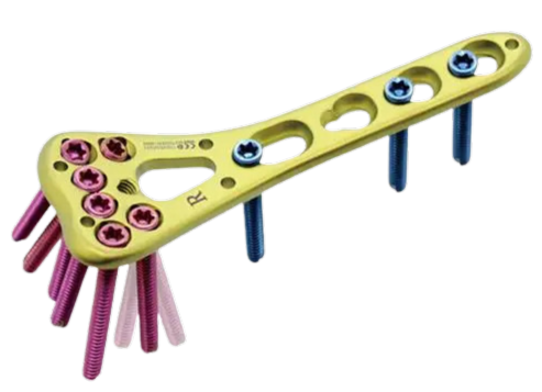 Yellow bone plate with pink and blue screws on a white background