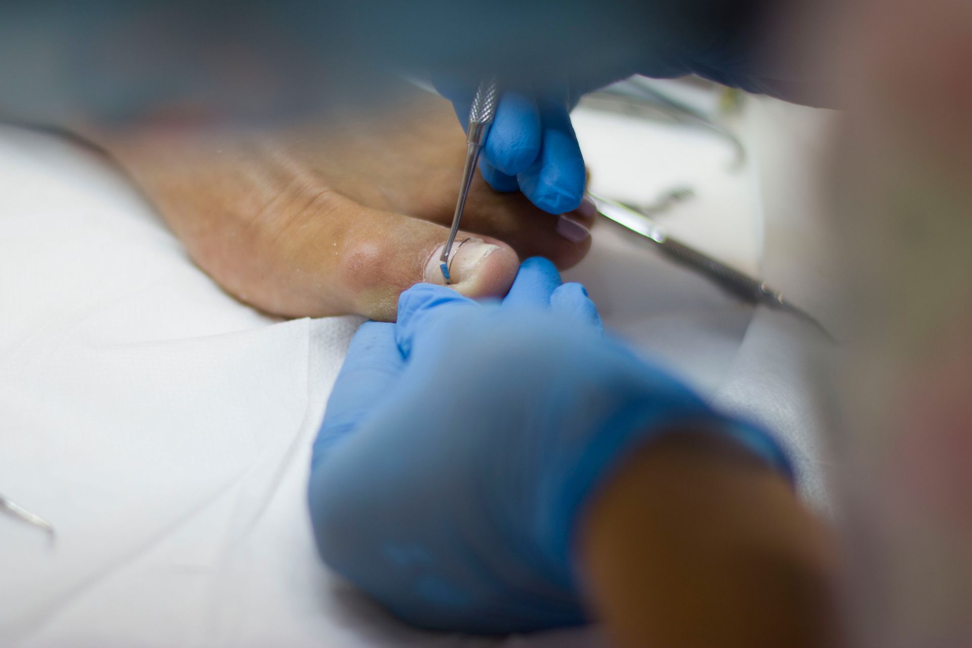 A una persona le están cortando las uñas de los pies con un podólogo.