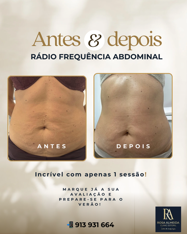 Pessoa recebendo massagem com pedras quentes nas costas, com as mãos aplicando as pedras.