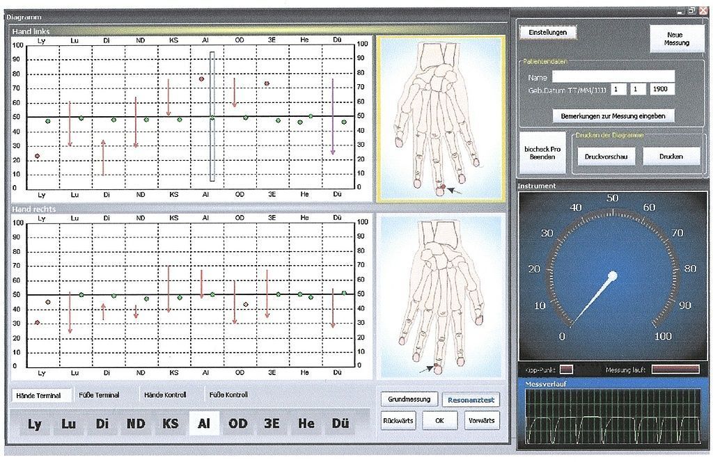 Elektroakupunkturmessung nach Dr. Voll