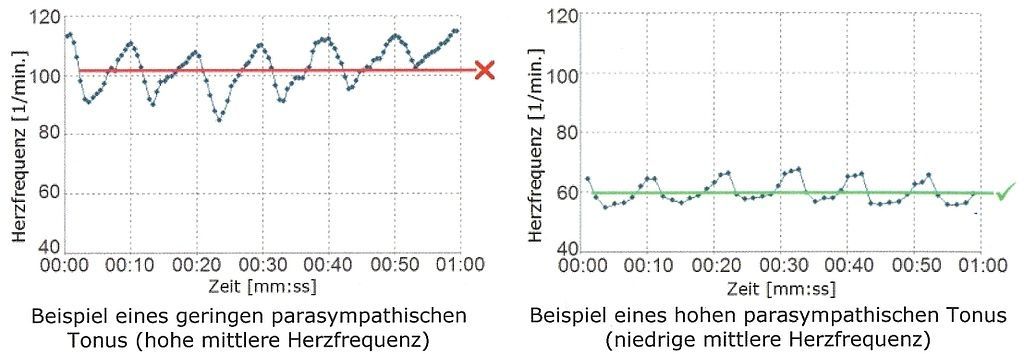 Herzfrequenzvariabilitäts-Messung