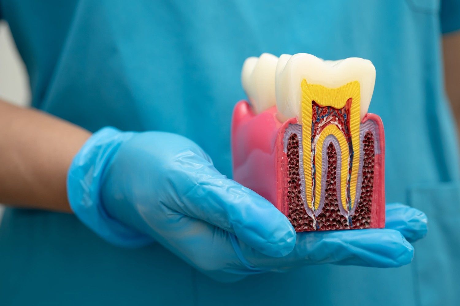 Una mano enguantada de azul sostiene un modelo de sección transversal de un diente incrustado en tejido gingival rosado.