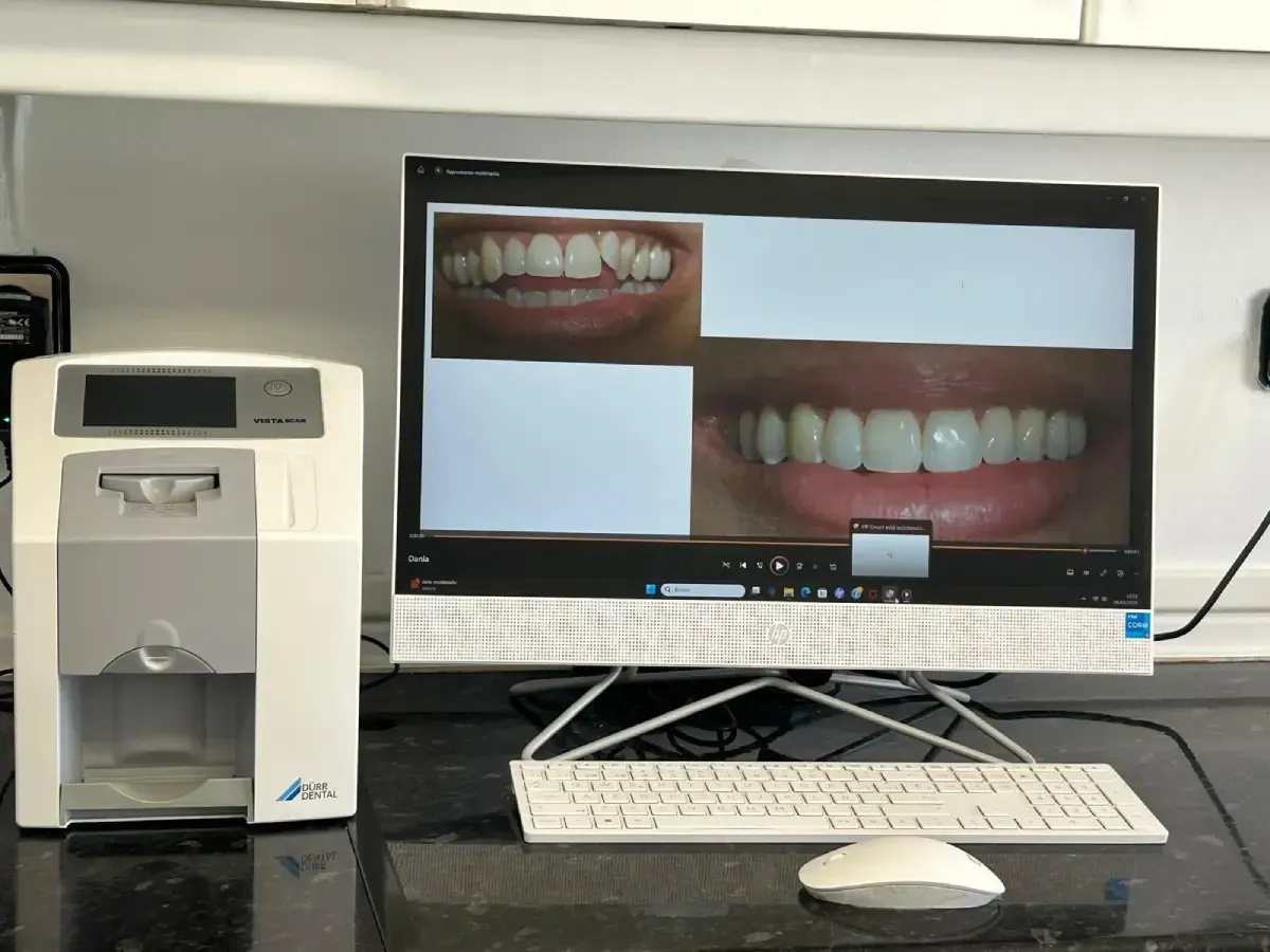 En el escritorio de una clínica, un dispositivo de imágenes dentales se encuentra junto a un monitor de computadora