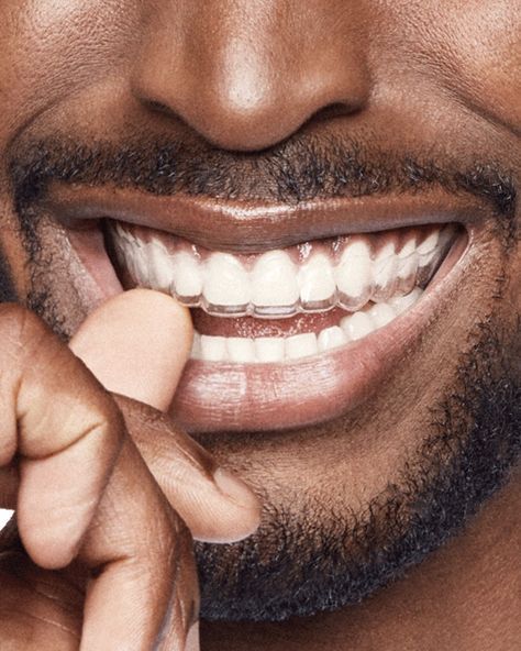 Persona sonriendo, con alineadores dentales transparentes, dedo cerca de la boca.