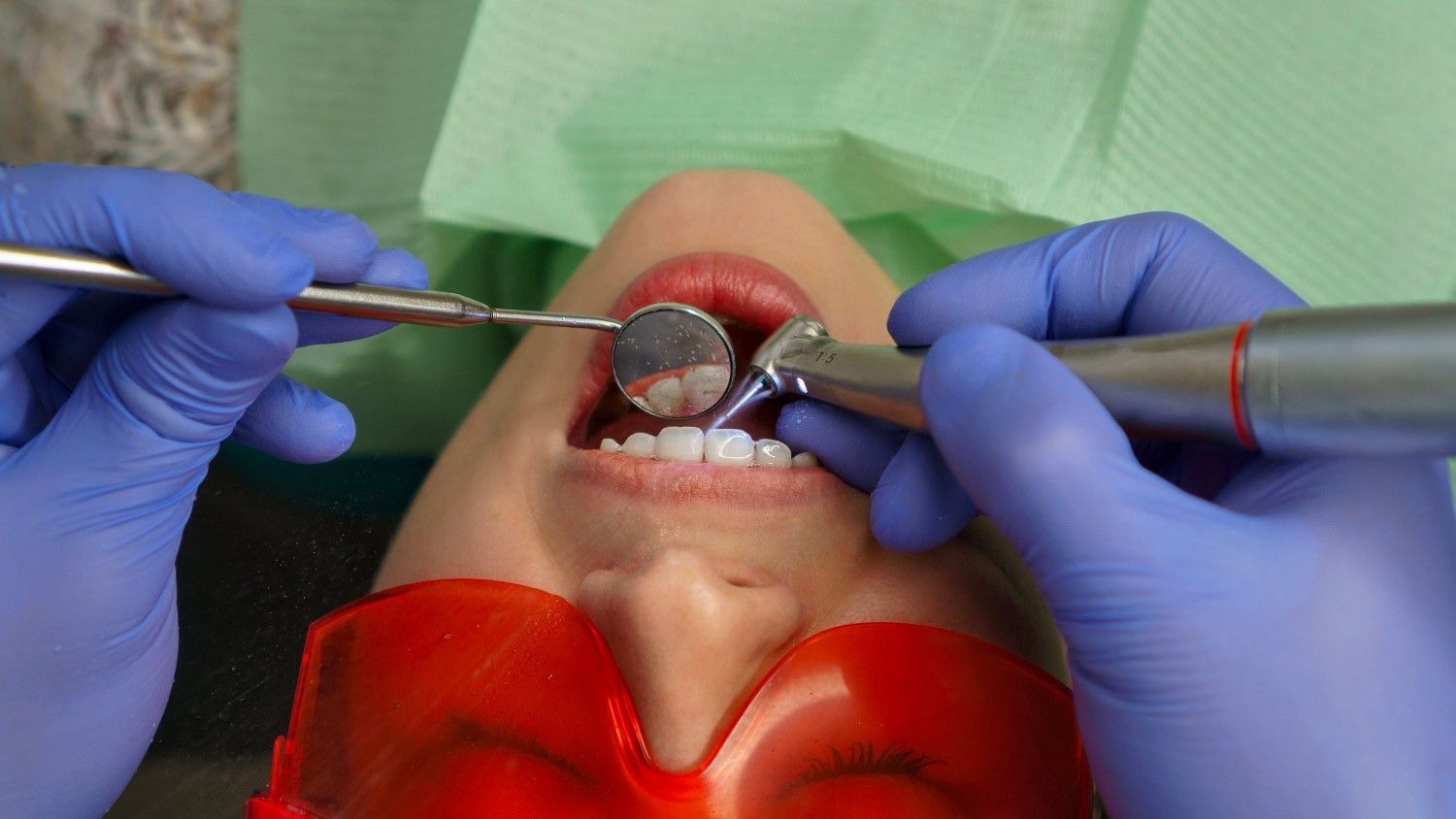 Dentista utilizando espejos e instrumentos dentro de la boca abierta del paciente, con guantes azules.