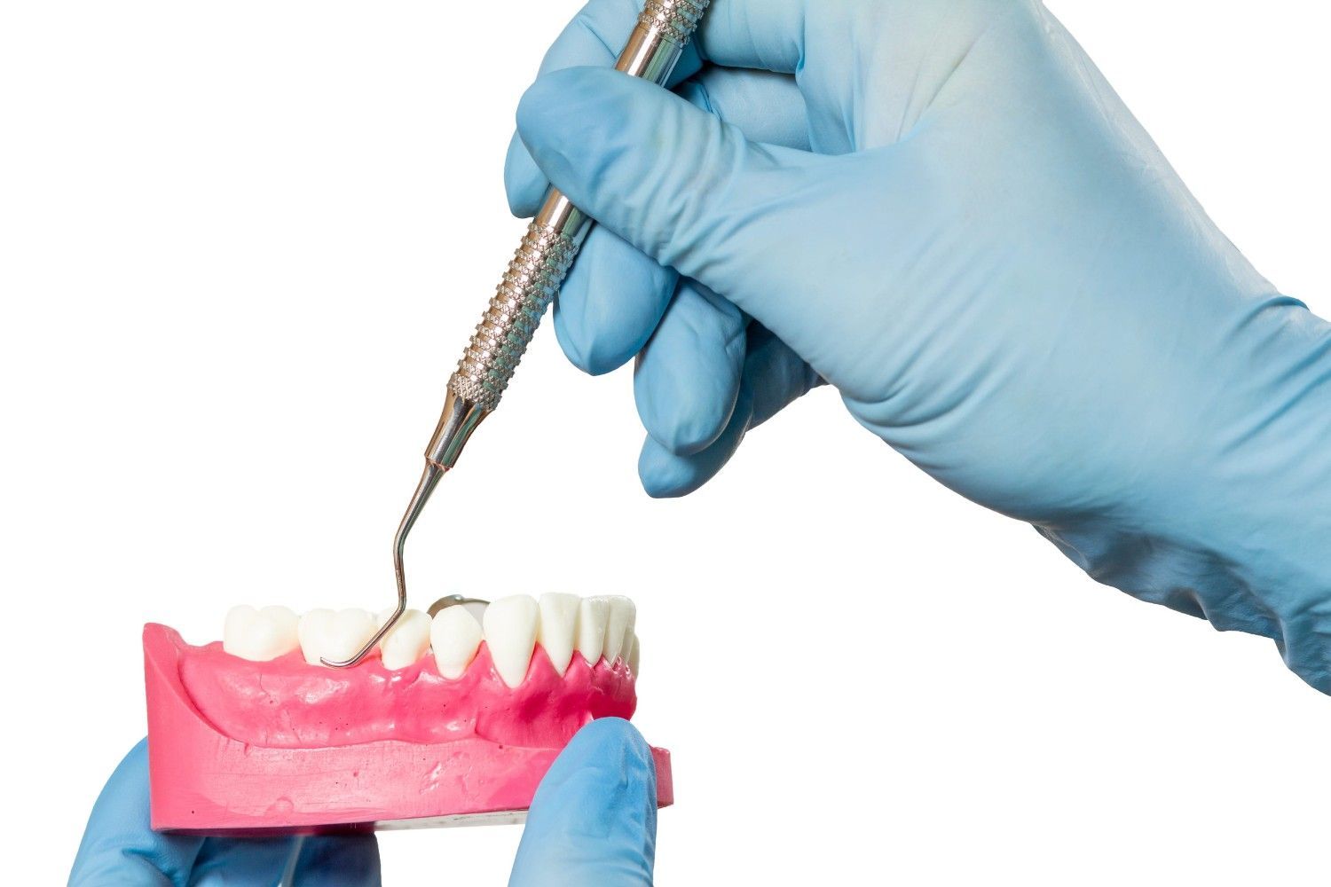 Mano enguantada utilizando un instrumento dental en un modelo de diente con encías rosadas.
