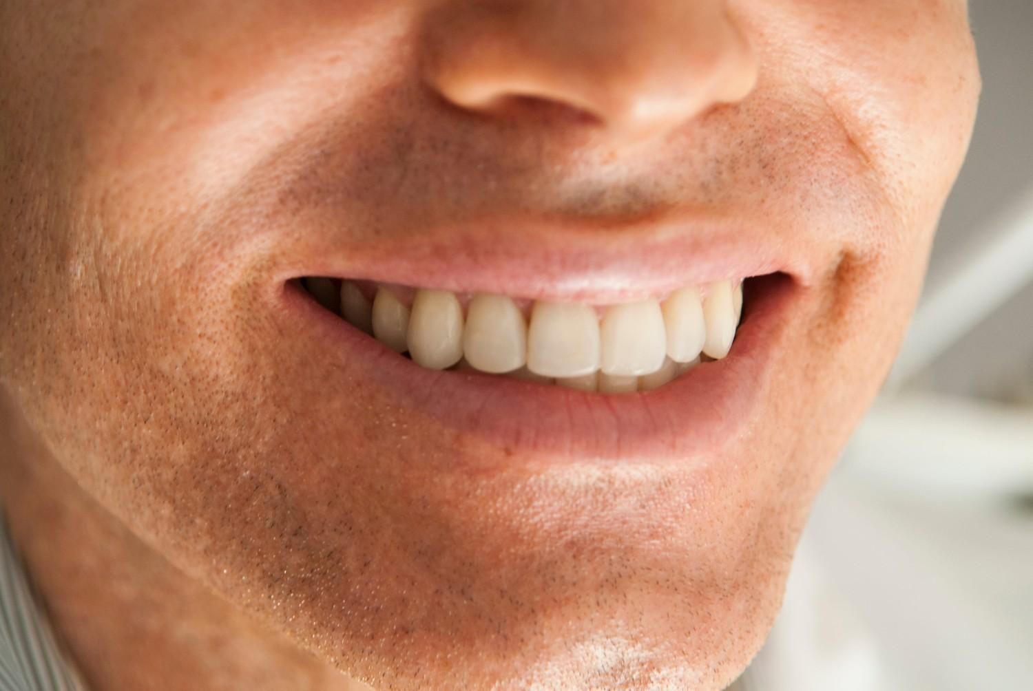 Primer plano de una boca y dientes sonrientes, que muestra una pequeña separación entre los dientes frontales.