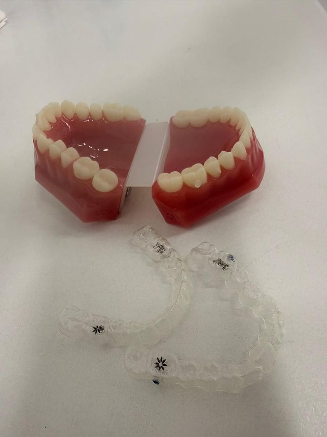 Un dentista con guantes ajusta los aparatos de ortodoncia de un paciente con herramientas dentales.