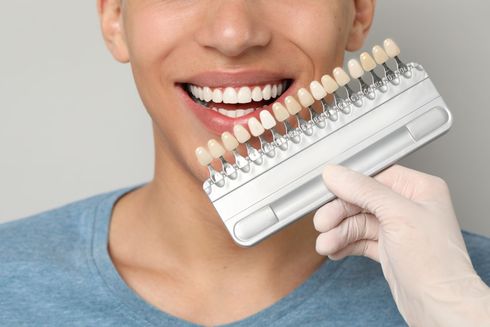 Guía de colores dentales sostenida cerca de una boca sonriente, comparando los tonos de color de los dientes.