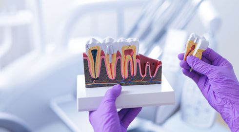 Manos enguantadas sosteniendo un modelo dental con cortes transversales de dientes en un entorno clínico.