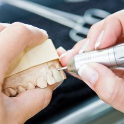 prothèse dentaire fixe - FRADENT Espace Dentaire SA