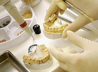 Clínica Dental Juriondo moldes dentales