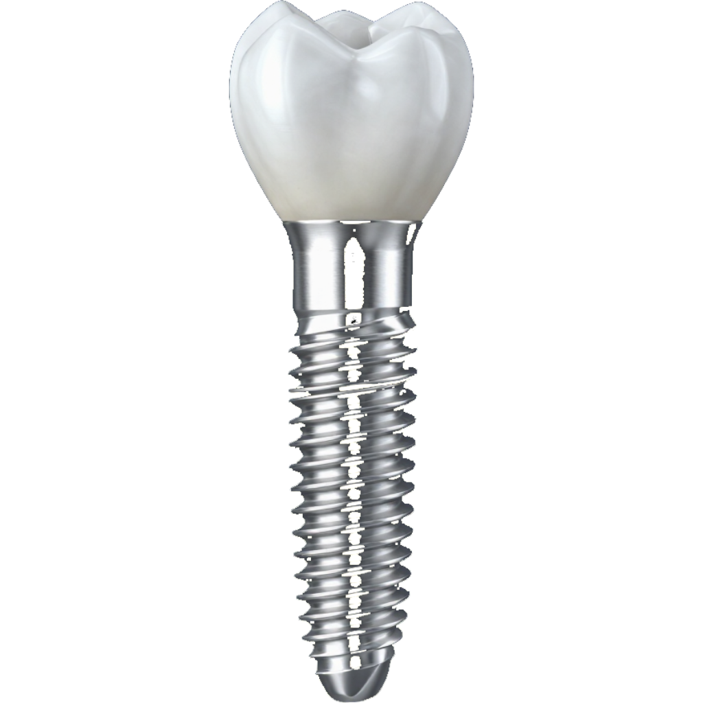 Implante dental con corona blanca y tornillo roscado plateado