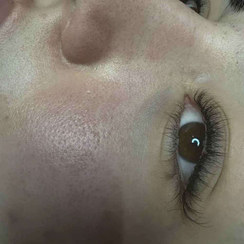 Primer plano del ojo de una persona con pestañas largas y oscuras y piel clara, con poros visibles y un ligero enrojecimiento.