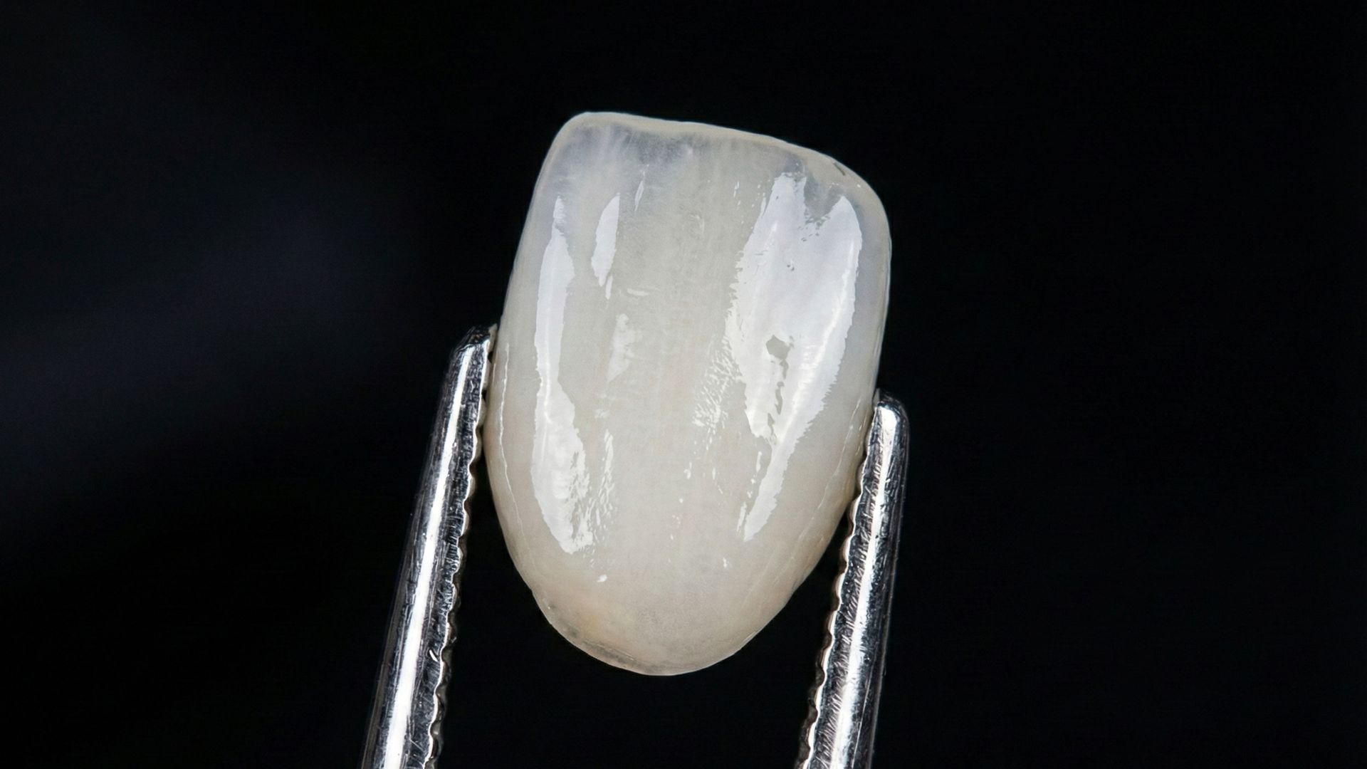Gros plan d'une dent blanche maintenue par une pince à épiler en métal sur fond noir