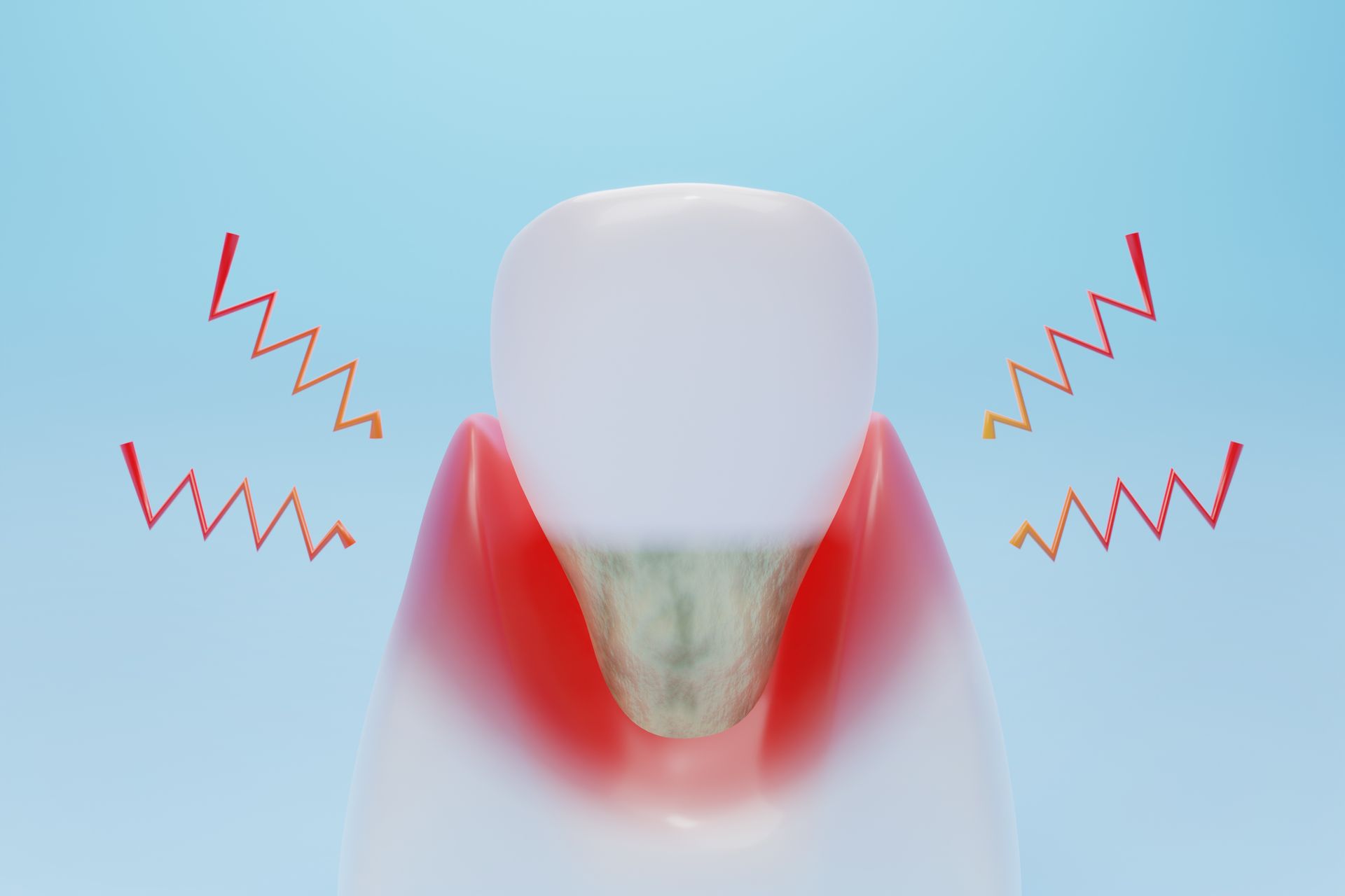 Dent avec des marques de douleur gingivale rouges sur fond bleu