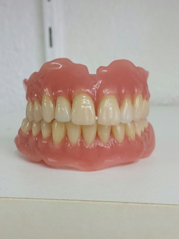 Vollprothese - Pavlodent Zahntechnisches Labor - Baden