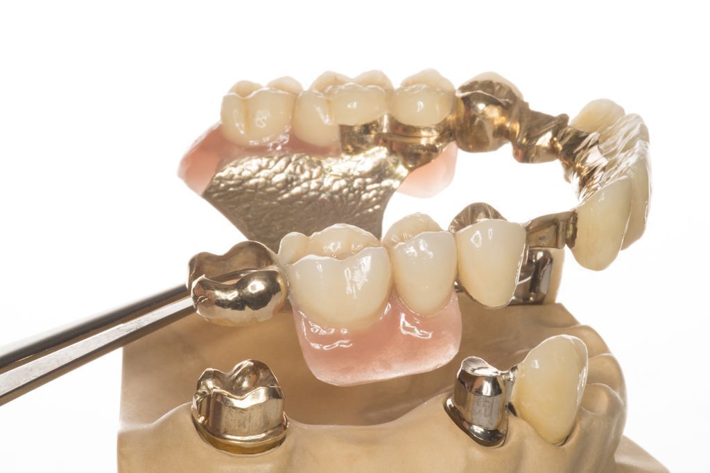 Dentallabor André G. Benoit Embrach - 3