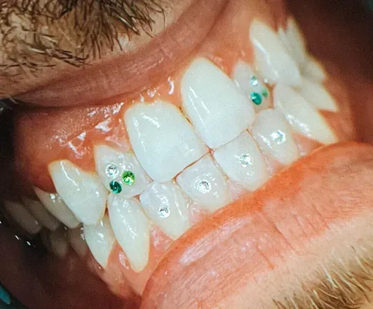 Un primer plano de los dientes de una persona con diamantes de imitación.