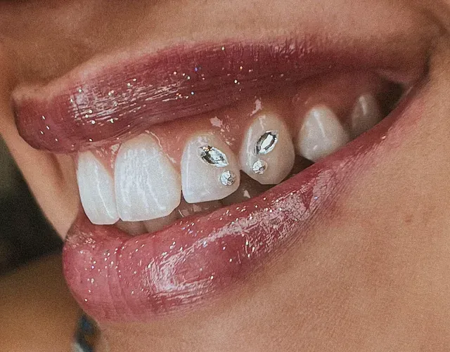 Un primer plano de los dientes de una mujer con diamantes de imitación.