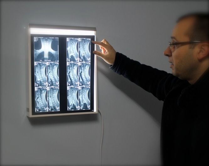 Un hombre señala una radiografía en la pared.