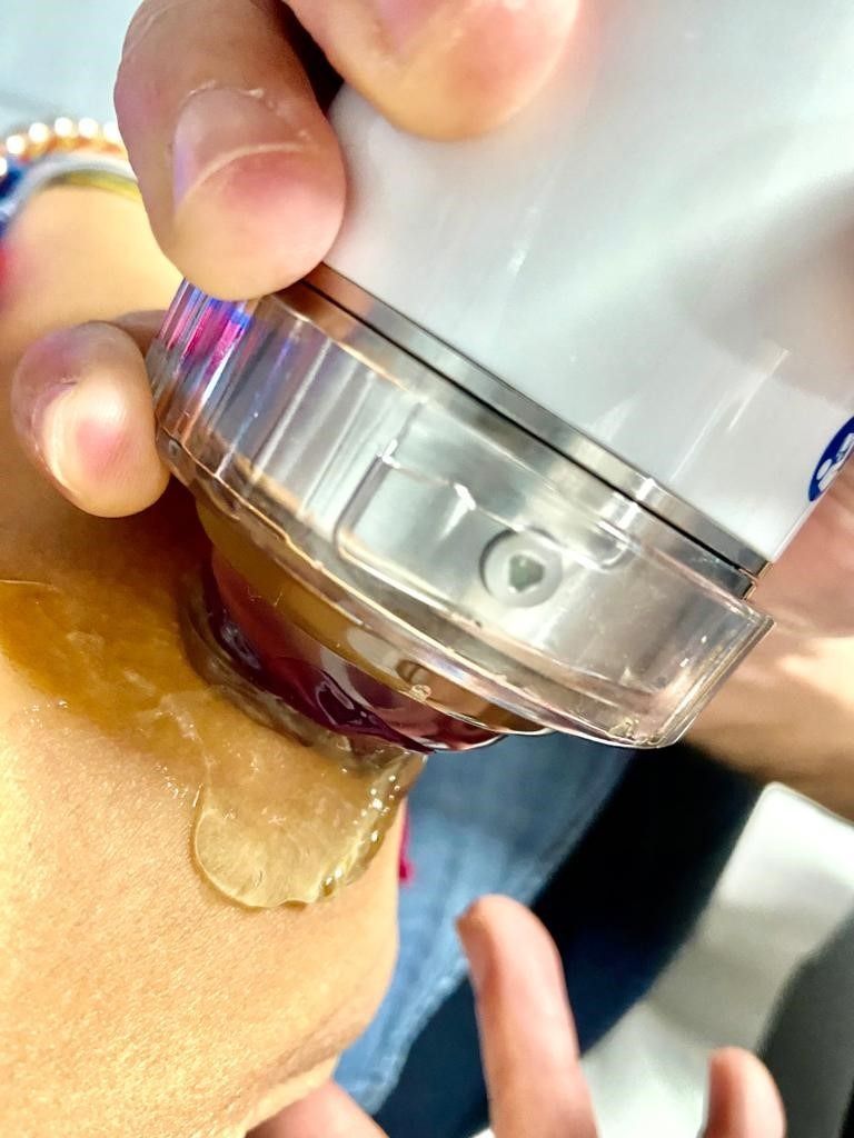 Un primer plano de una persona usando un dispositivo en su cara.