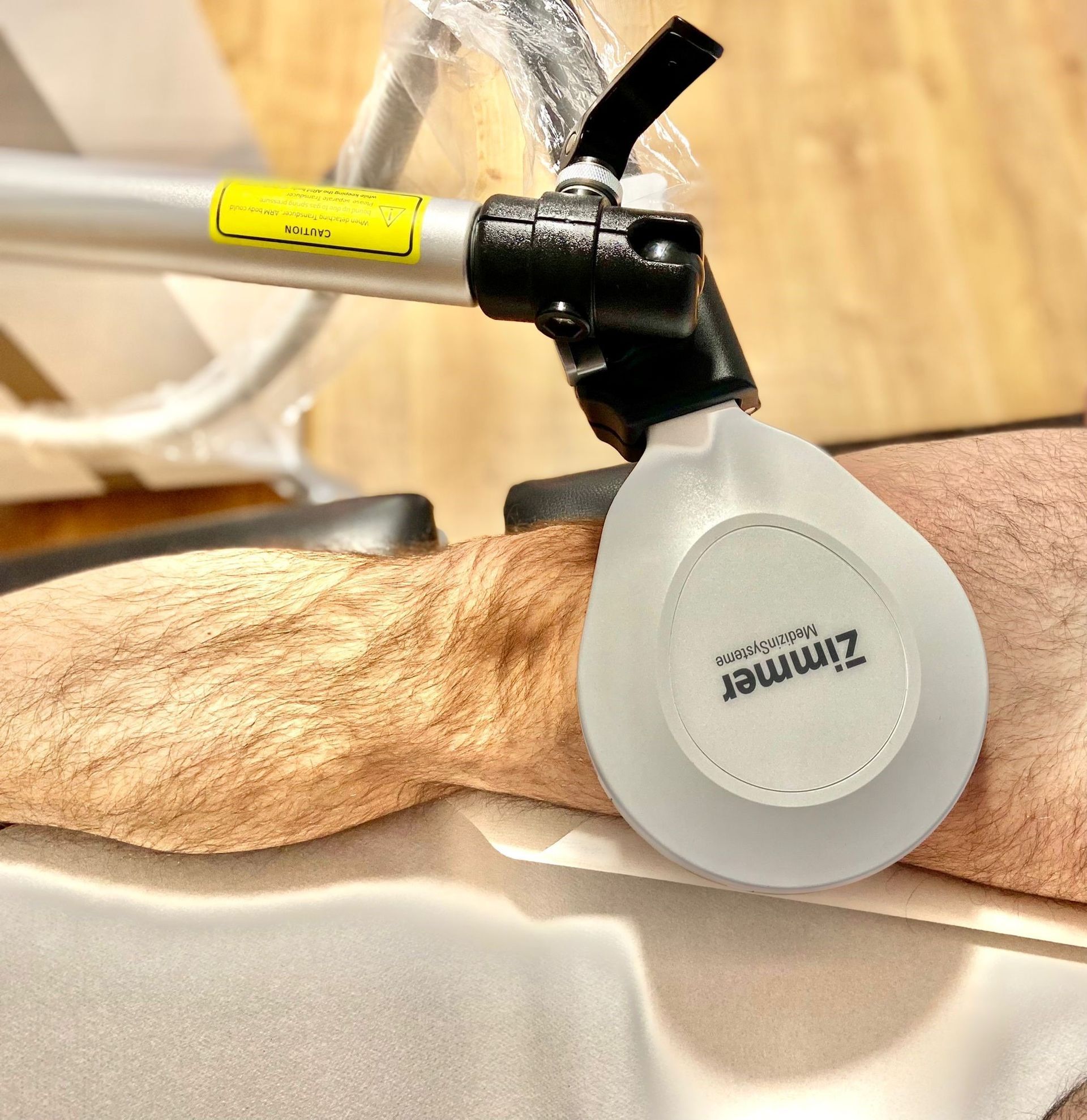 Se está utilizando un dispositivo Zimmer en el brazo de un hombre.