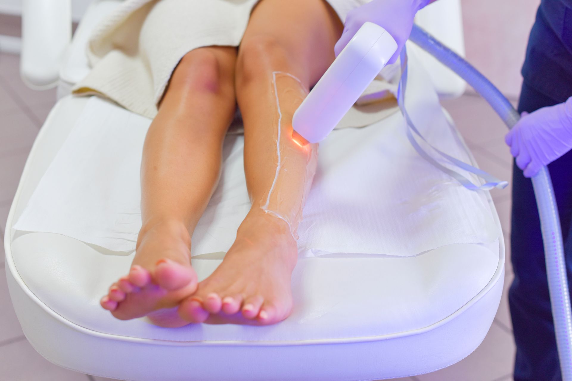 Épilation à la lumière pulsée sur des jambes