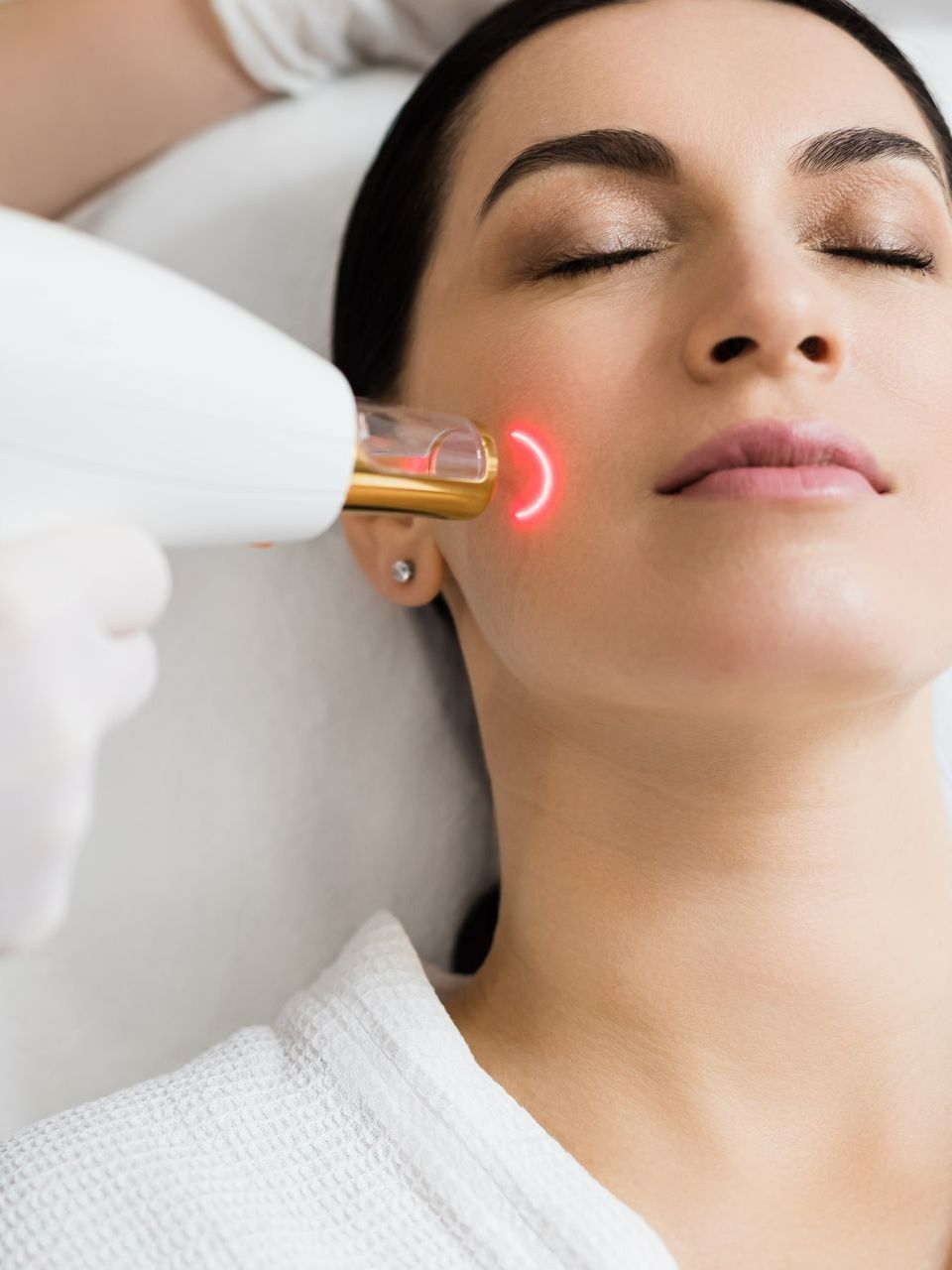 Épilation du visage à la lumière pulsée