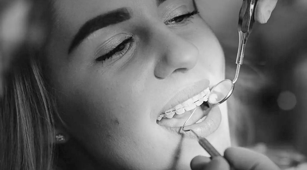Mujer con aparatos dentales durante un examen dental en el consultorio de un dentista.