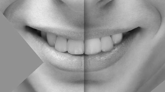 Primer plano de una boca sonriente, bisecada con un efecto de escala de grises.