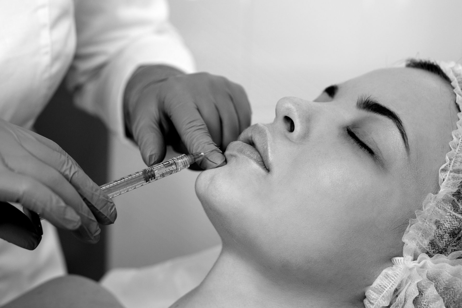 Una persona que recibe inyecciones de relleno de labios con una mano enguantada en un entorno médico.