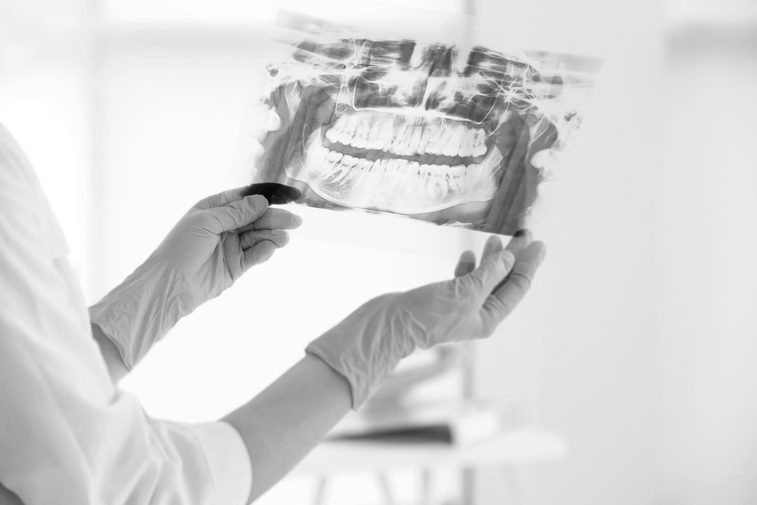 Dentista sosteniendo y examinando una radiografía de los dientes de un paciente.