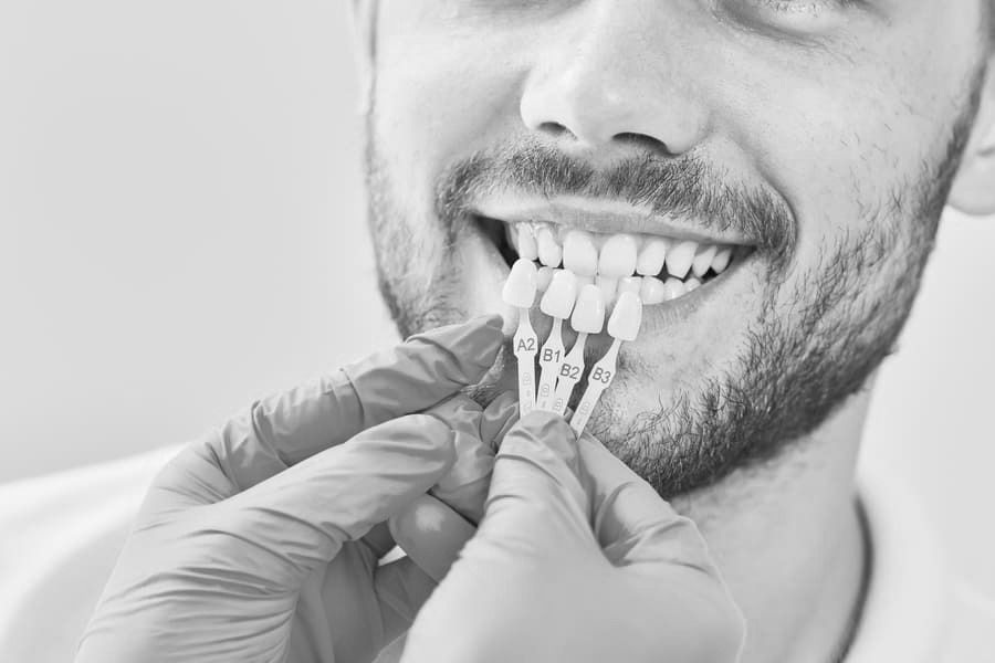 Dentista comparando el tono de los dientes con una guía de colores con un paciente sonriente en una clínica dental.