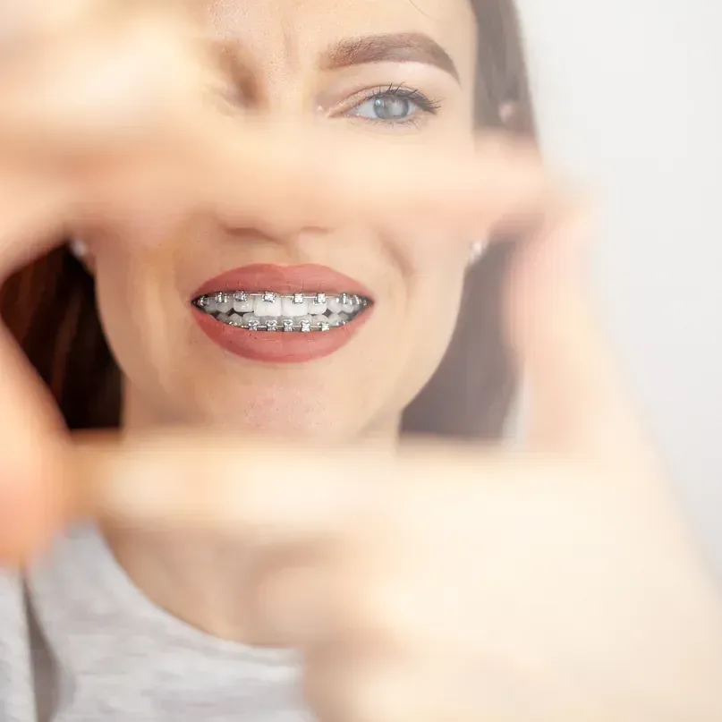 Una mujer con aparatos dentales se cubre la cara con las manos.