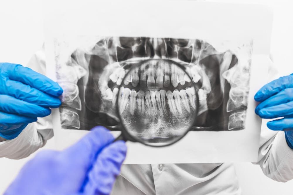 Un dentista sostiene una radiografía de los dientes de un paciente.