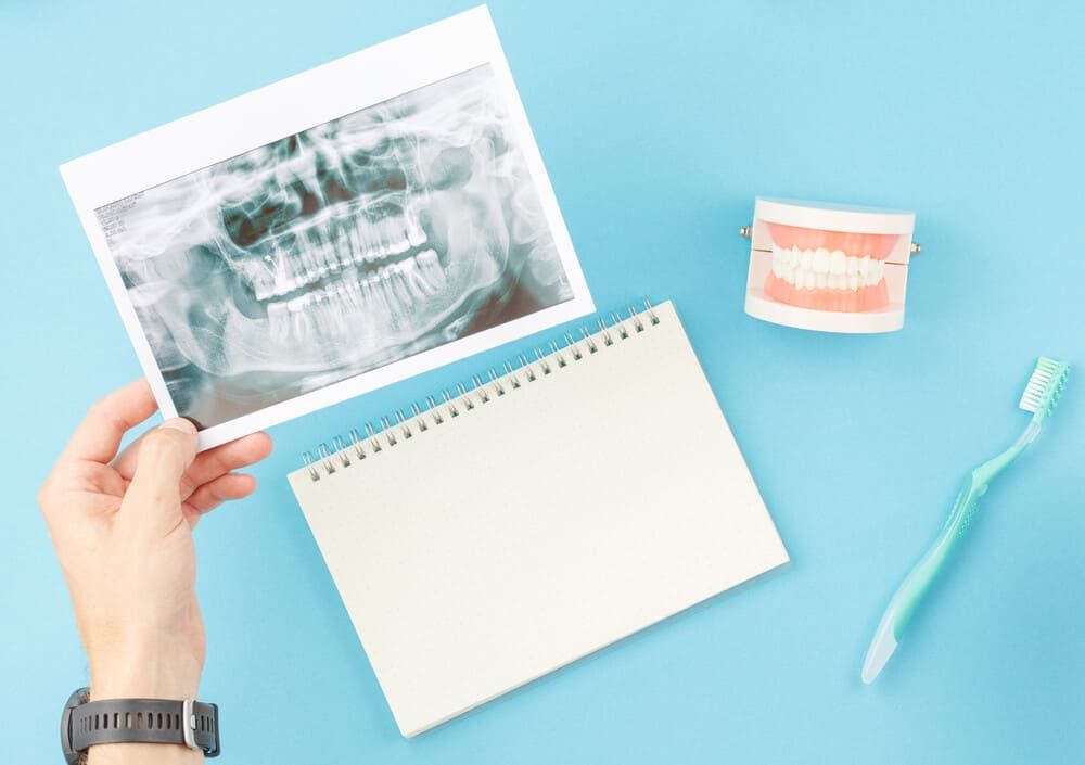 Una persona sostiene una radiografía de sus dientes junto a un cepillo de dientes y un cuaderno.