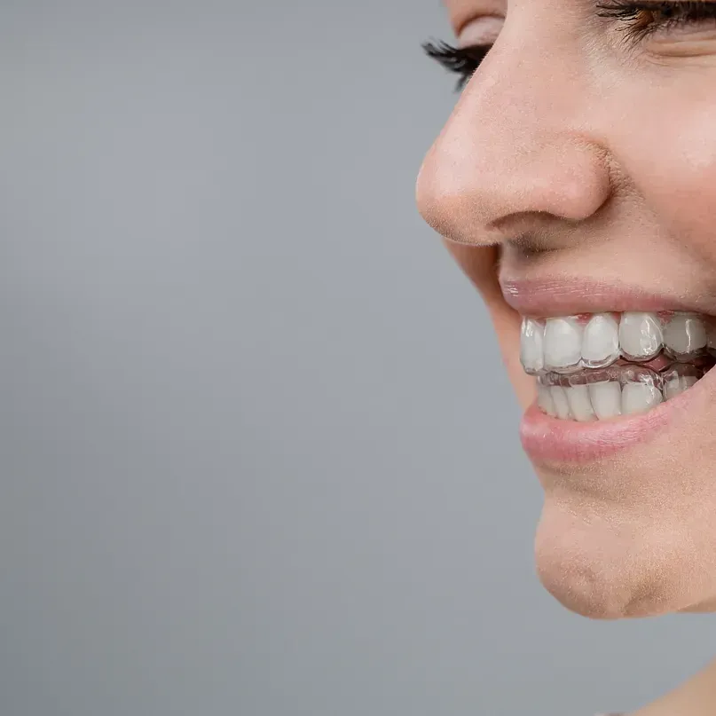 Un primer plano del rostro de una mujer con aparatos dentales.