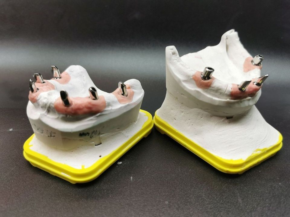 Zwei Zahnabdrücke mit rosa Zahnfleisch und Metallspangen auf gelben Sockeln vor dunklem Hintergrund