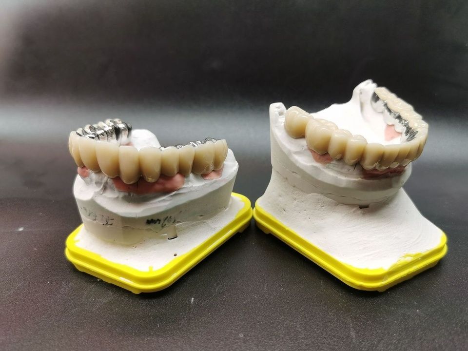 Zwei Zahnabdrücke mit Ober- und Unterkieferprothesen auf gelben Unterteilen